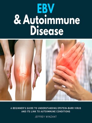 cover image of EBV & Autoimmune Disease